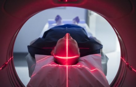 MRI